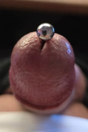 Dilator