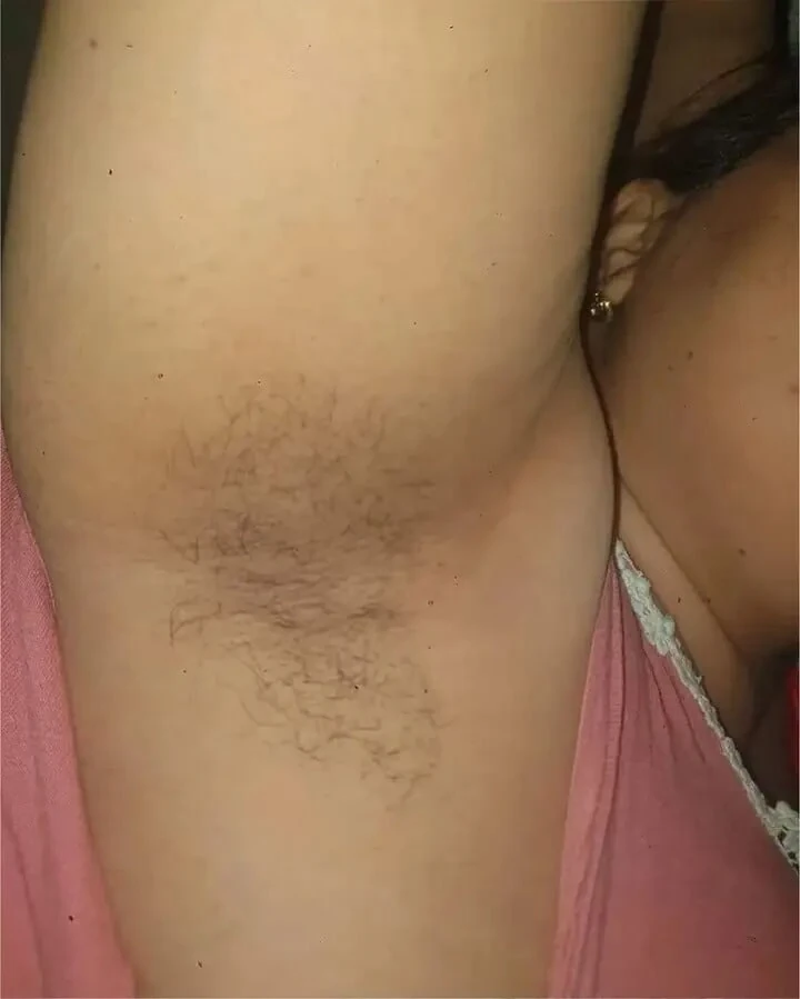 Bhra terfisi 