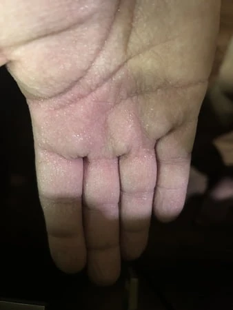 Pruny