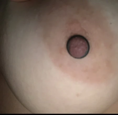 Nippel schon blau vor Schmerz