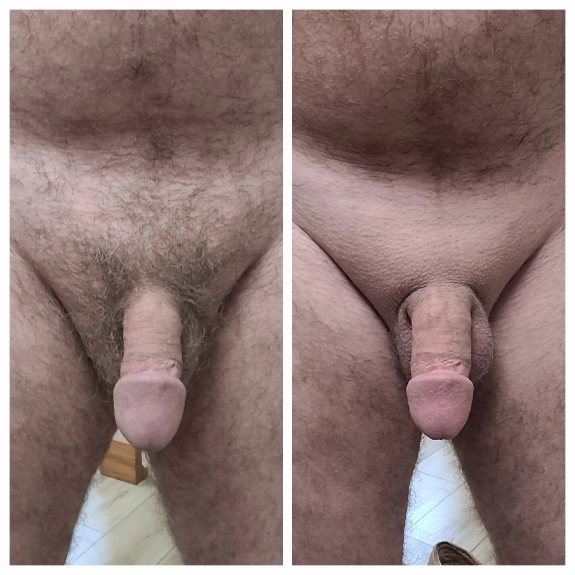 Бритая против волосатой