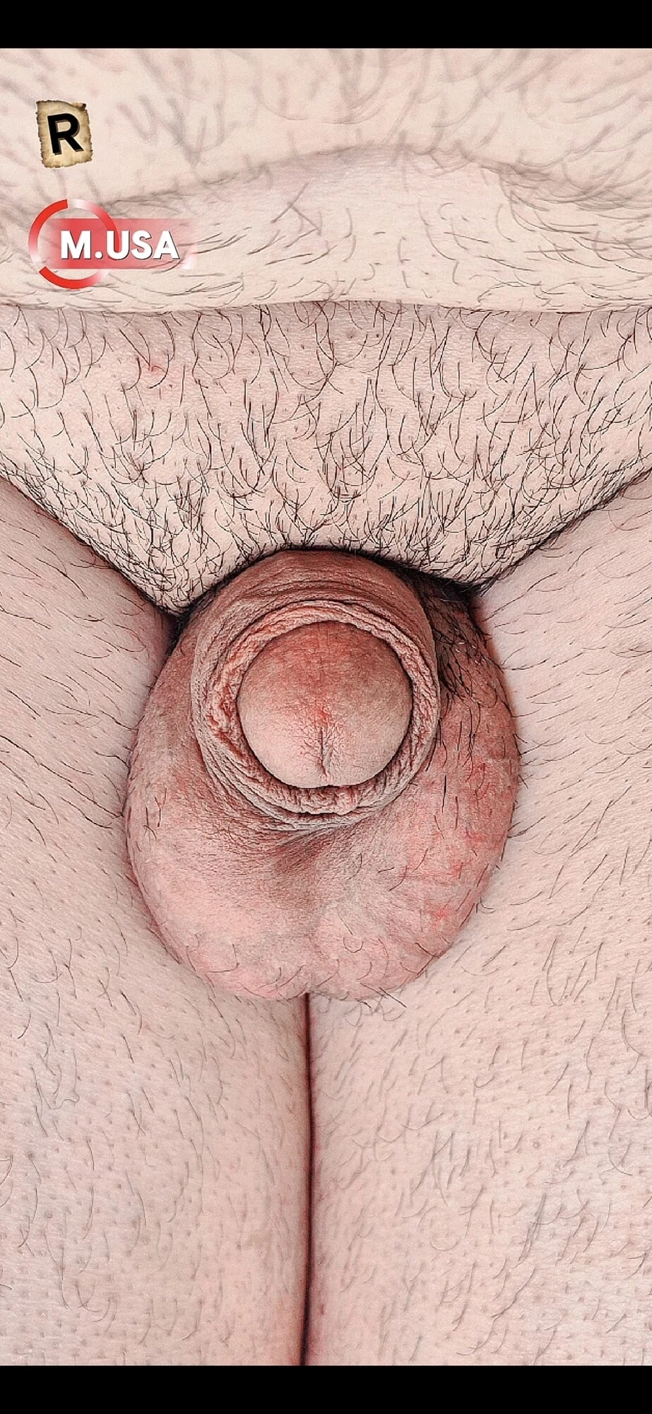 Top