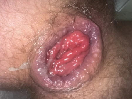 Oxball ff pighole'da anal prolaps