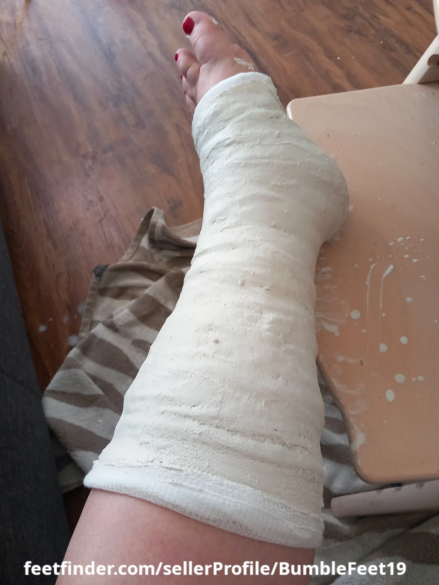 Session: Applying a short leg cast (SLC) on my left leg #3