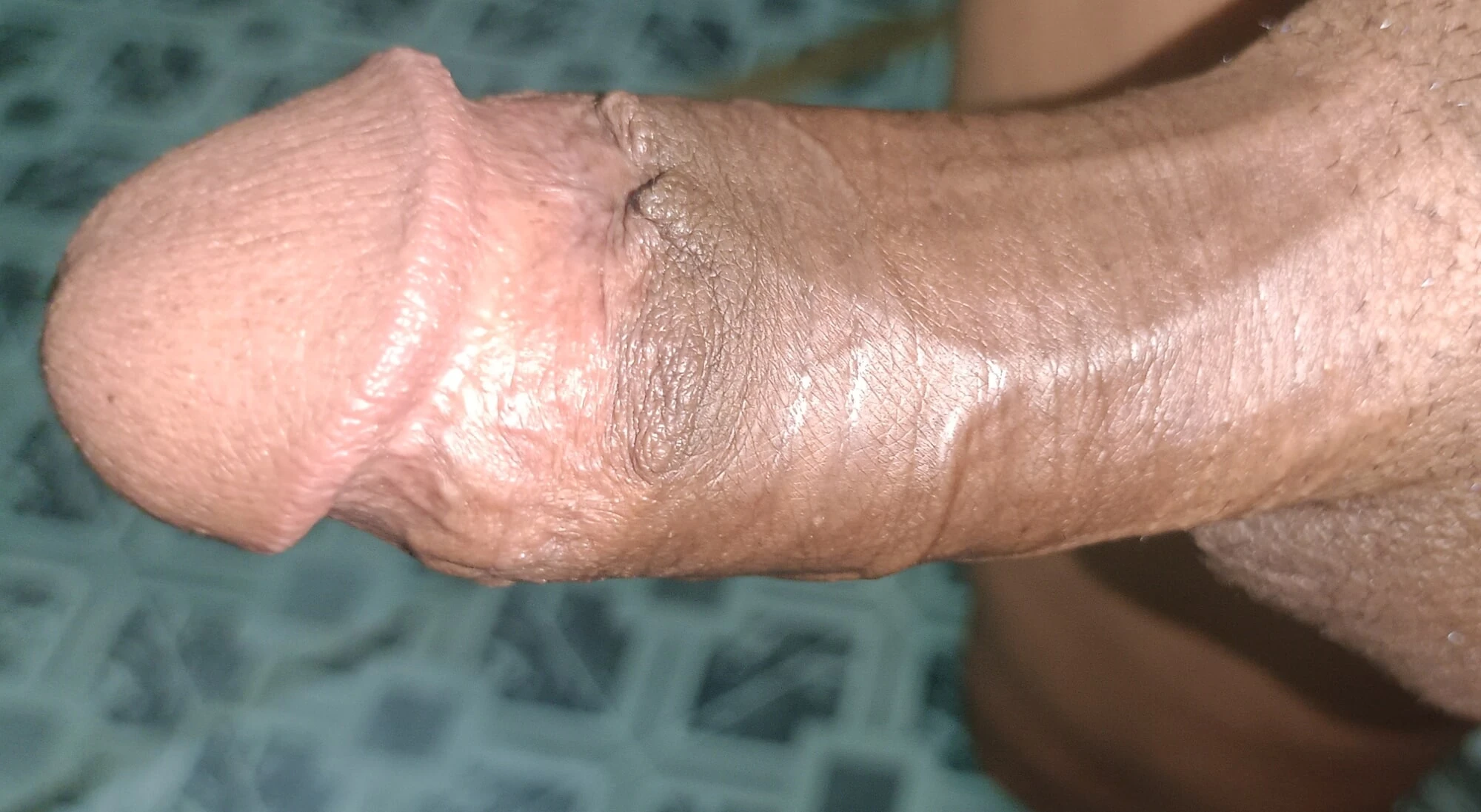 Penis