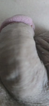 Penis