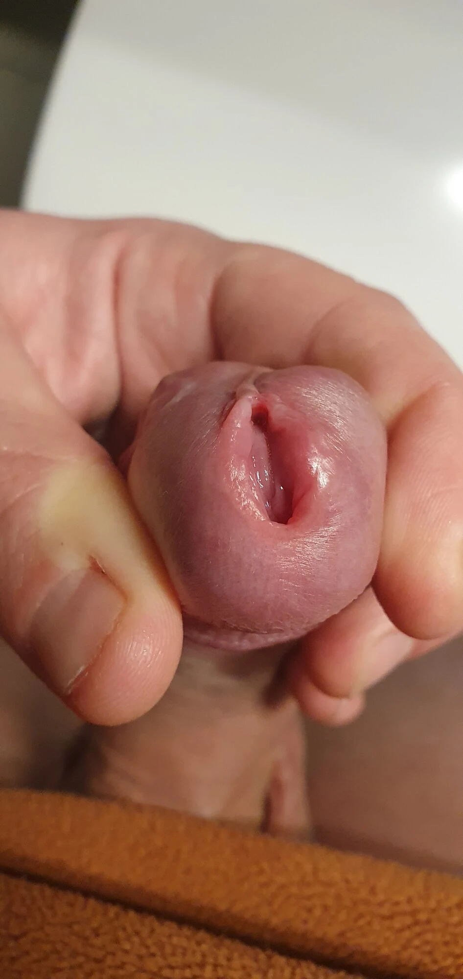 Mein riesen Pissloch