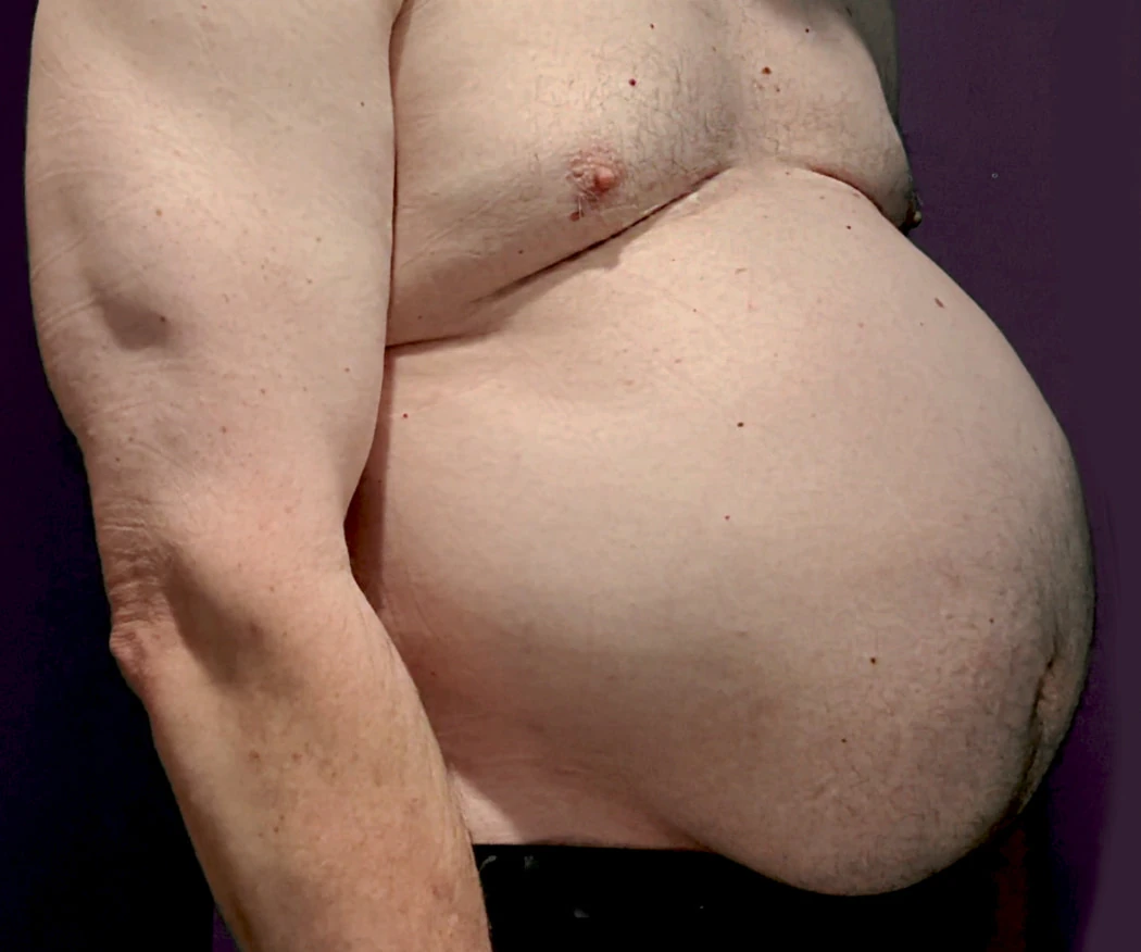 Ximd9000 Большой раздутый живот