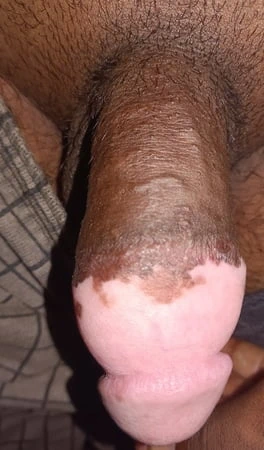 Uzun ömürlü penis 