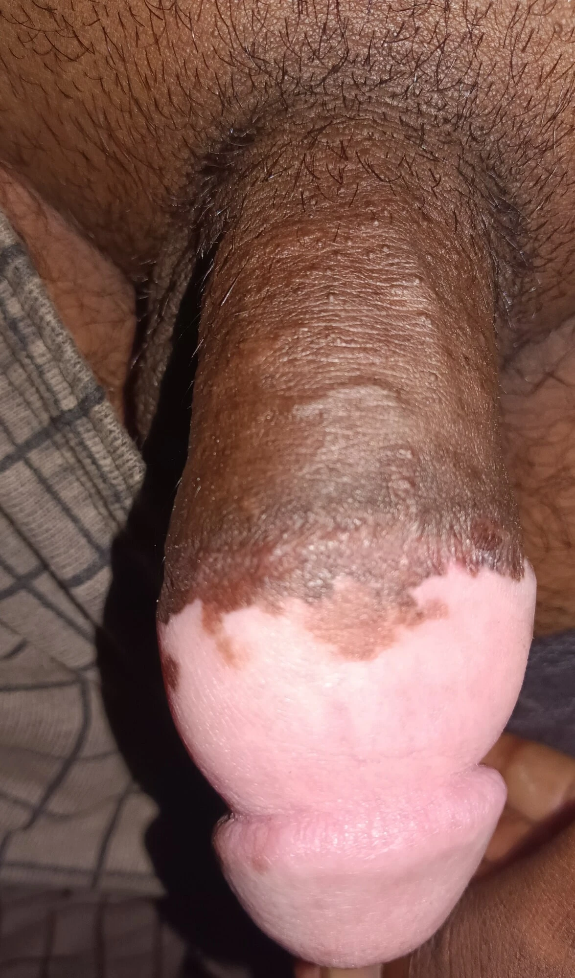 Долговременный пенис 