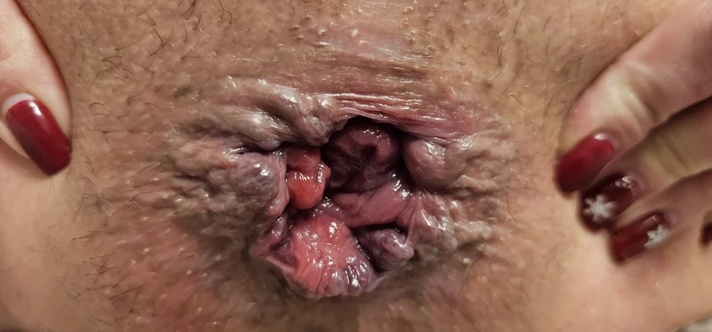 And what do you think about my anal gaping? #3