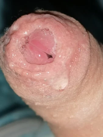 Aletim