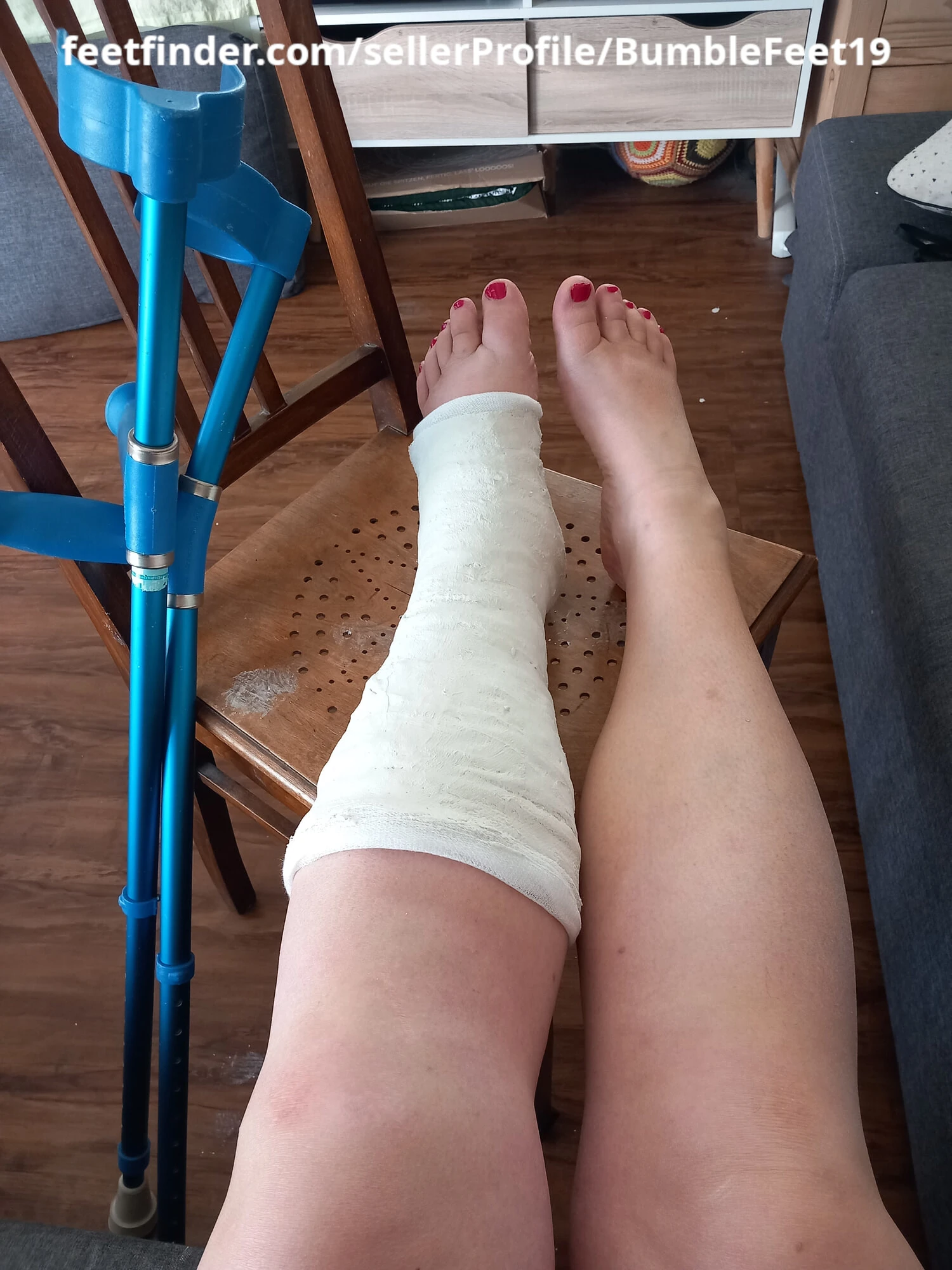 Session: Applying a short leg cast (SLC) on my left leg #4