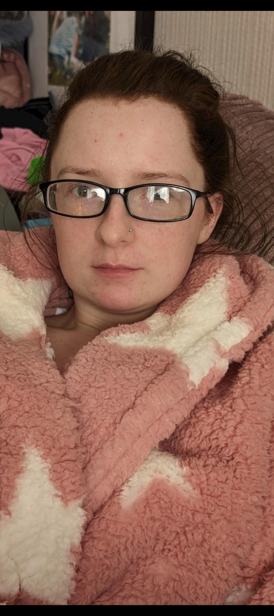 If you cover my face in cum, you won't see my spots 
