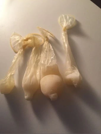 Dondurulmuş döl ve döllenmiş prezervatifler