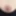 Breast