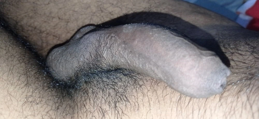 Penis - fimoz ve peyroni