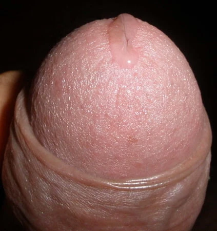 Katkıda Bulunma