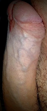 Gel bin 