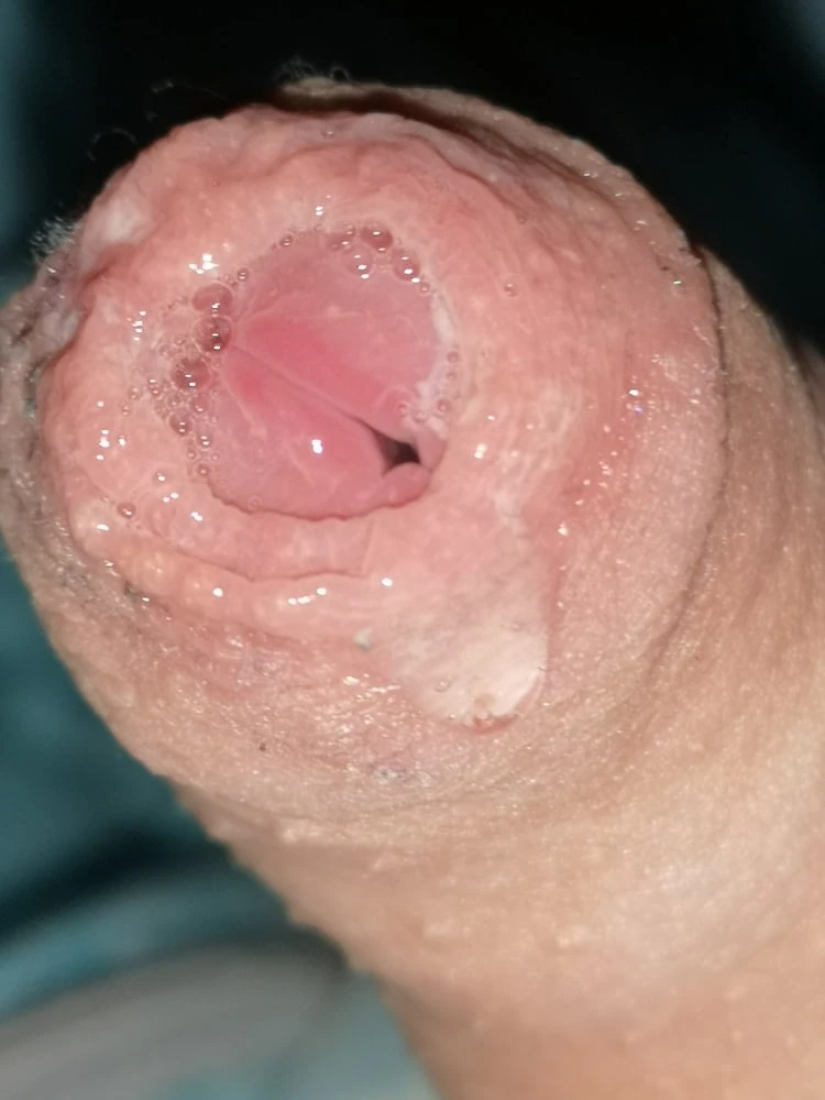 Aletim