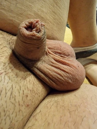 Küçük penis
