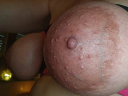 Meine Brueste, Bubi, Memeten 