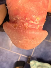 Meşe palamudu peyniri veya çıplak peynir