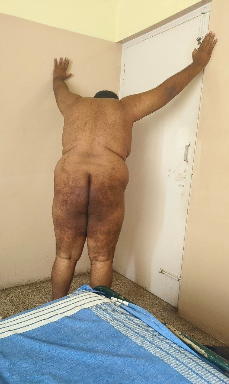 Ateşli vücudum ve şişmanım 