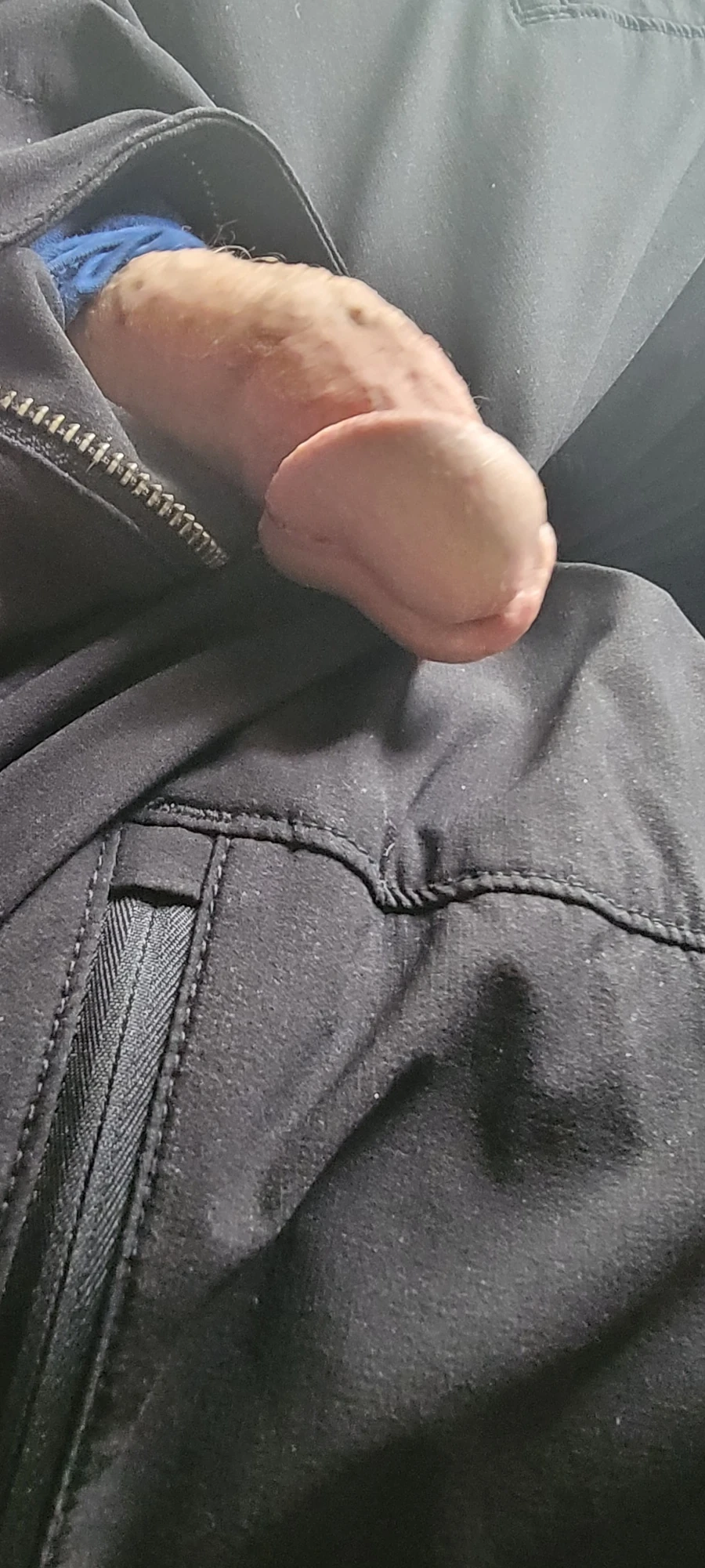 İkiye ayrık penis başım