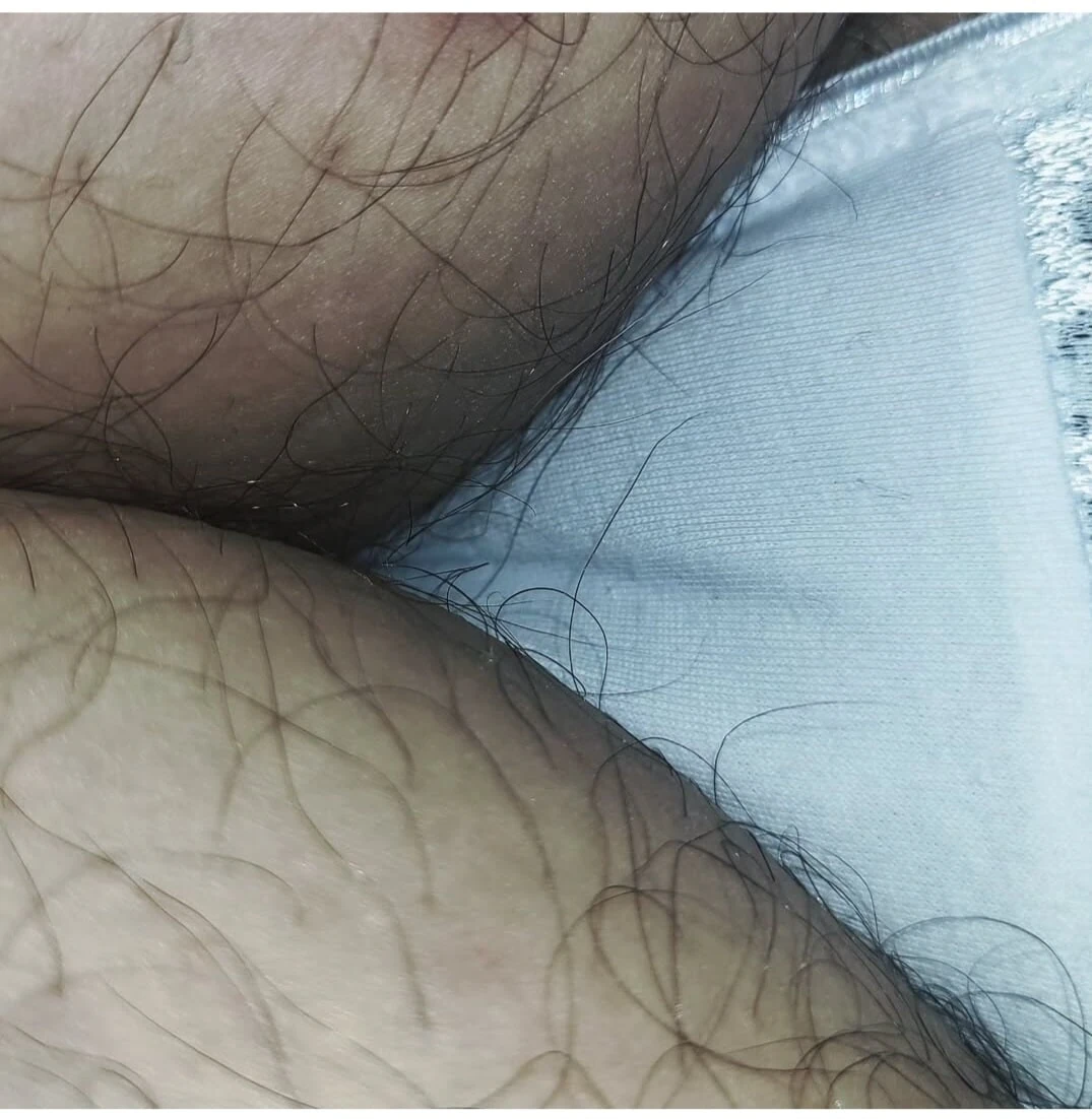 Pelos kıllı 