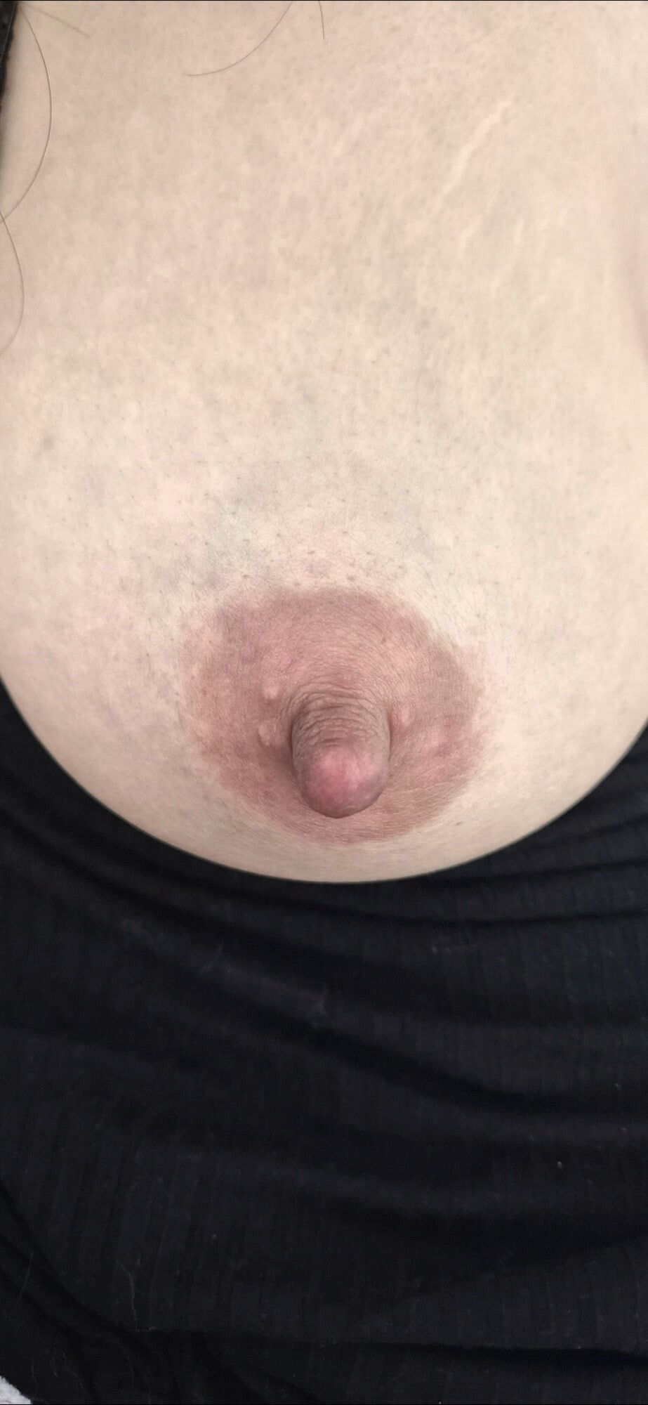 Breast
