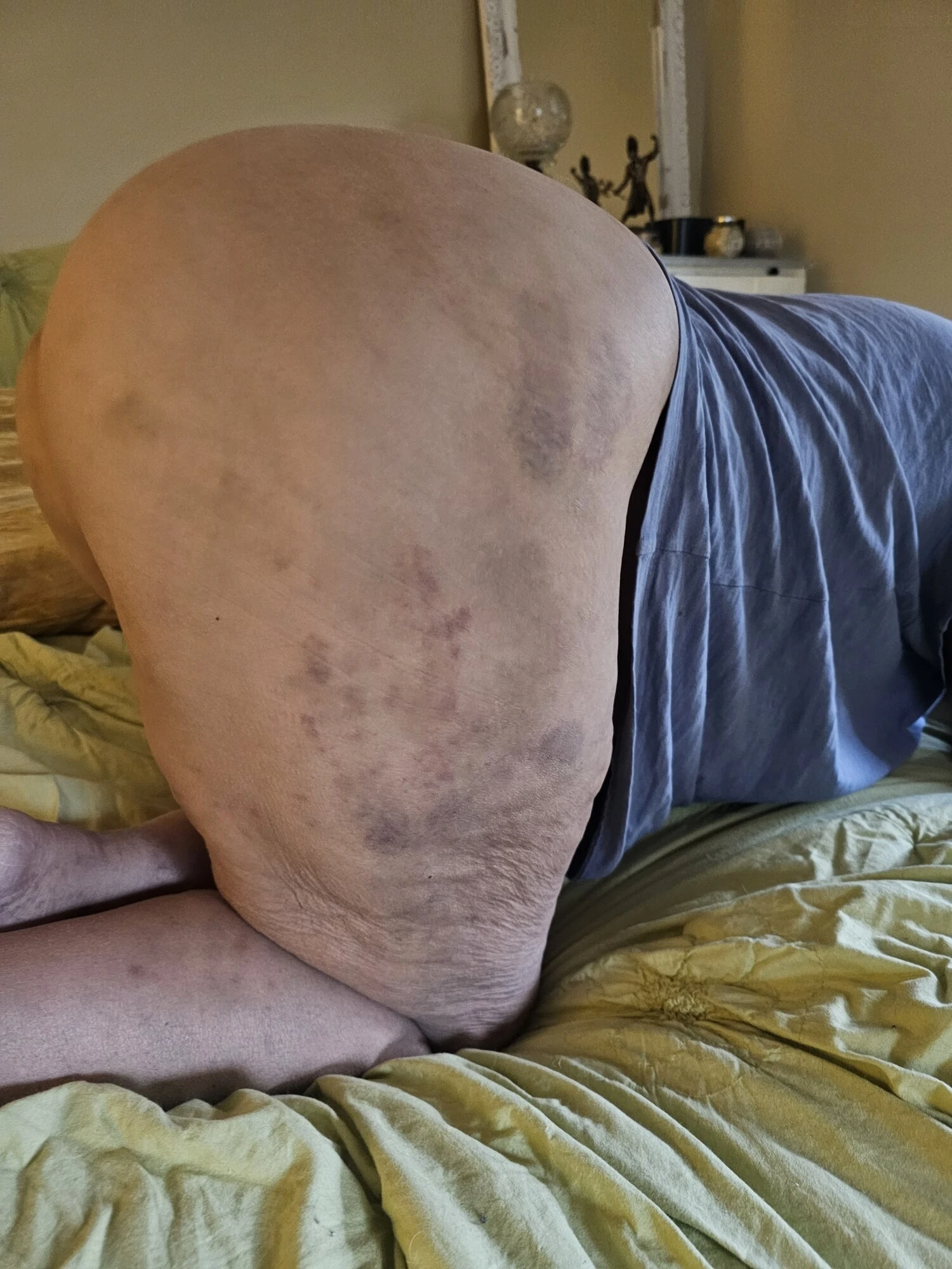 Rastgele bir bakış