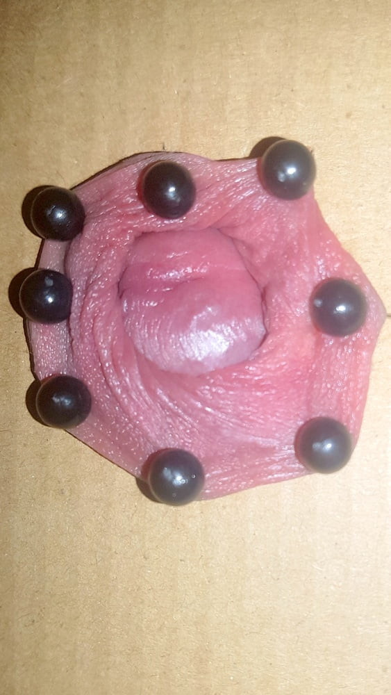 Taşaklara iğneler 2