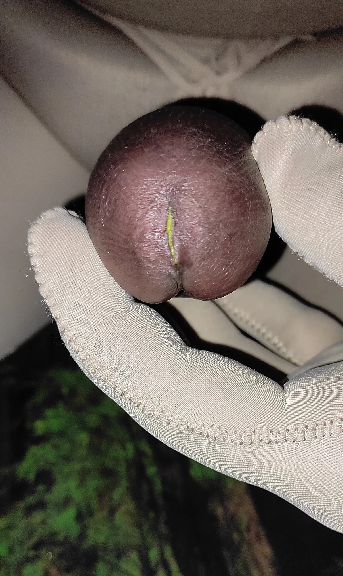Süper Yapıştırıcı Penis İdrar Deliğinde