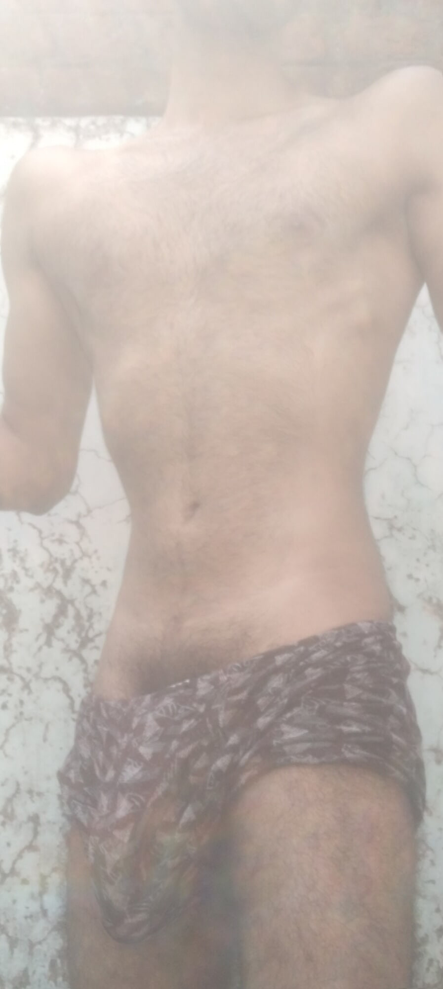 Kıllı, yüksek testosteron sorunu 