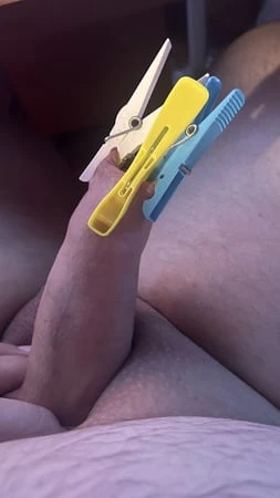 Mandalı sünnete kıskaç takıyor