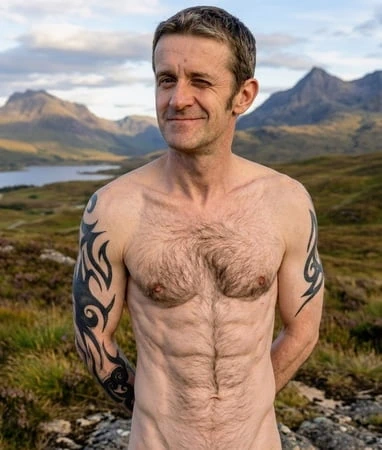 İskoç adamın ilgiye ihtiyacı var 