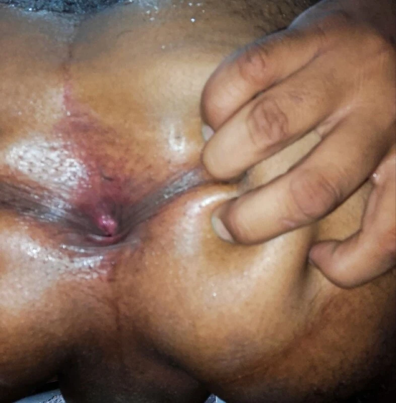 Culo peludo