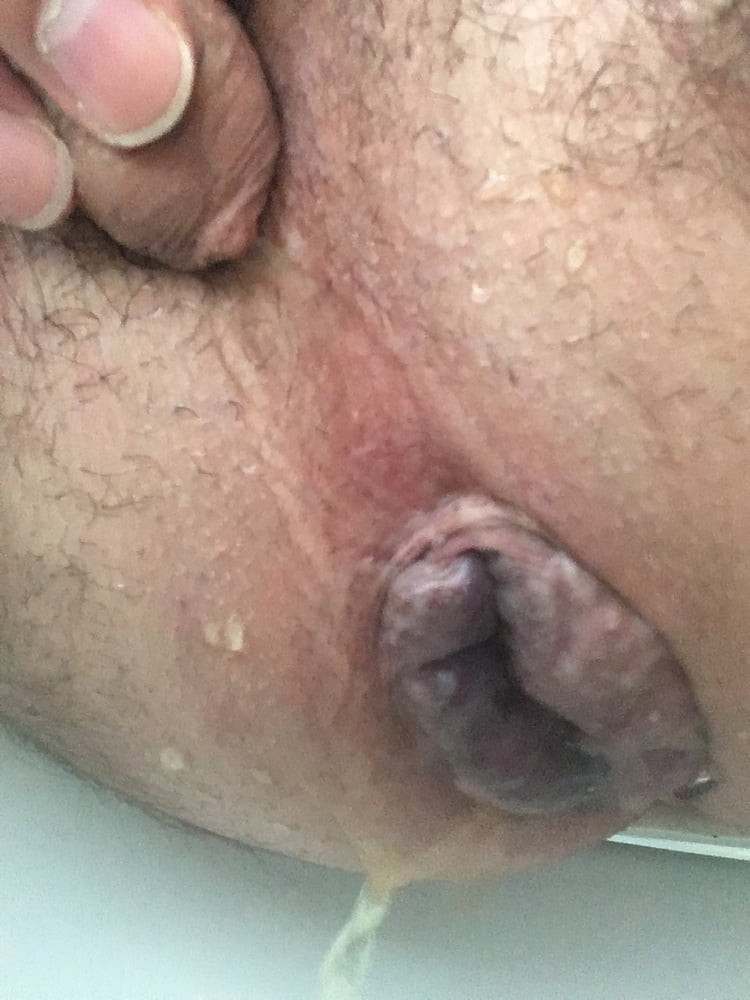 Kahve ve çiş pissing