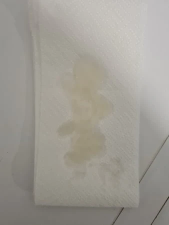 Sperma