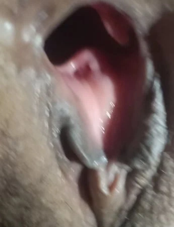 Pantat lubang longgar